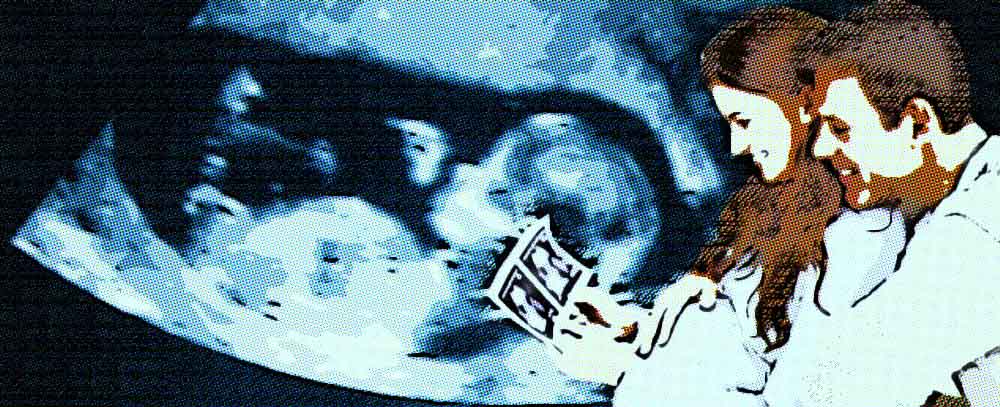 costos de ecografías: 2d, 3d y 4d