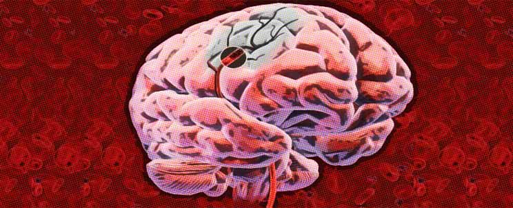 ¿Cómo prevenir y evitar un ACV o "Accidente Cerebro Vascular"?