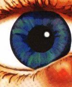 ¿Qué es un orzuelo?