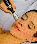 Tratamiento láser para verrugas en la cara