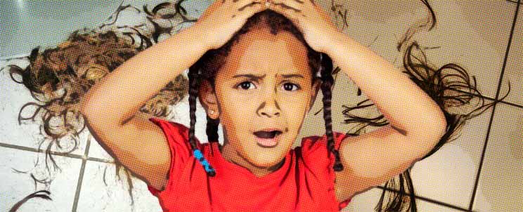 Alopecia en niños