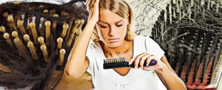 tratamientos de la alopecia seborreica