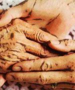 Cuidado de los ancianos