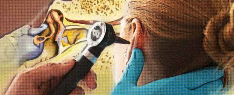 Disolver y extraer un tapón de cera en mi oído