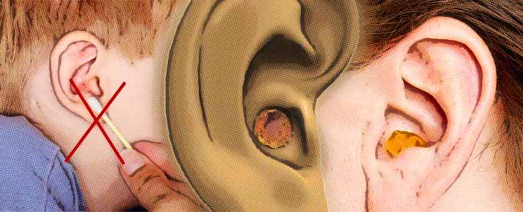 evitar el exceso de cera y los tapones en los oidos