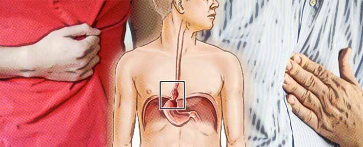 hernia de hiato