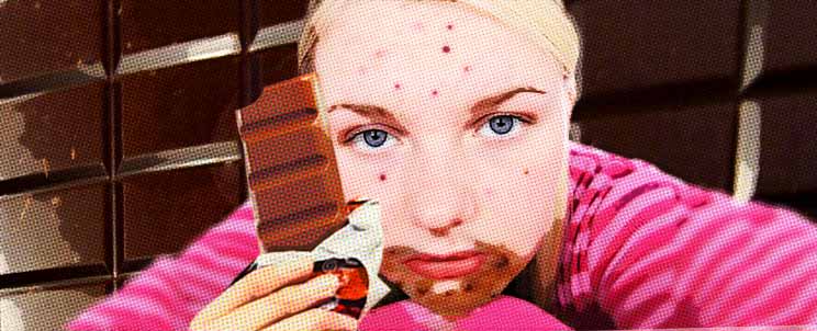 comer chocolate, ¿produce granos de acne?